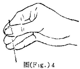 Insertion