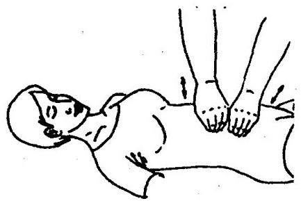Lifting Shaking Manipulation
