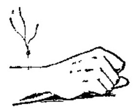 Moxibustion Therapy